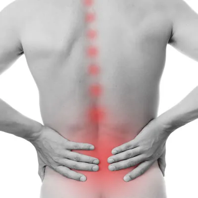 Illustration of sciatic pain travelling down the leg