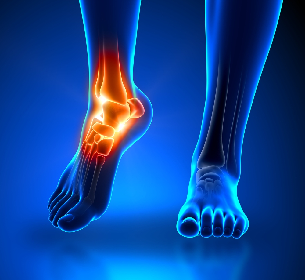 foot tendonitis