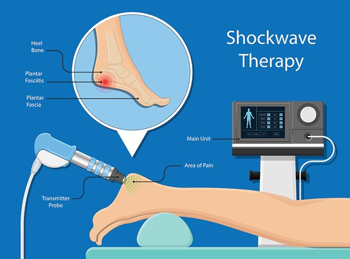 shockwave therapy machine